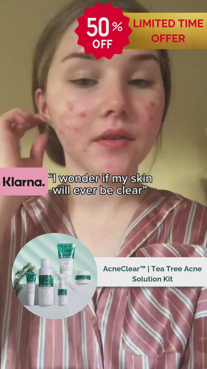 AcneClear™ | Tea Tree Acne Solution Kit