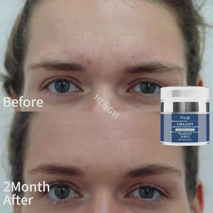 AgeDefy™ Retinol Cream | + FREE HydraGlow™ Hyaluronic Acid & PureLift™ Collagen Cream Combo – Ultimate Skin Care Set
